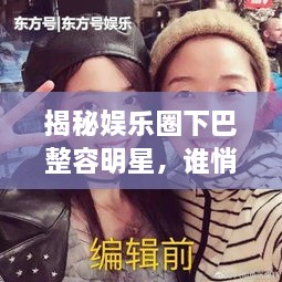 揭秘娛樂圈下巴整容明星，誰悄悄整過下巴？