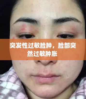 突發(fā)性過敏臉腫，臉部突然過敏腫脹 
