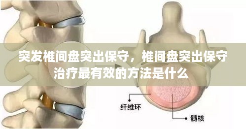 突發(fā)椎間盤突出保守，椎間盤突出保守治療最有效的方法是什么 